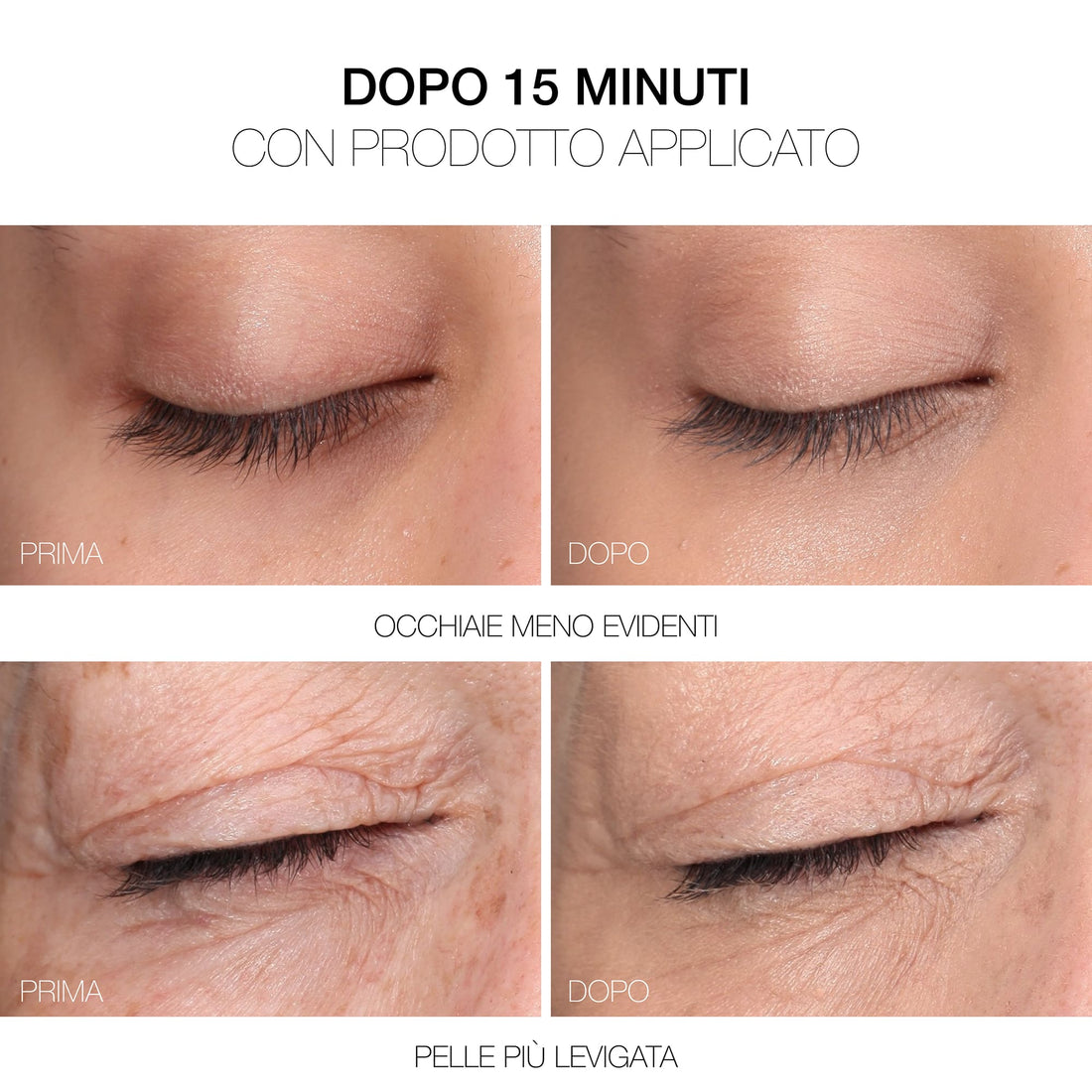 Meso Fill Concealer Fill&correct - Correttore Trattamento Levigante
