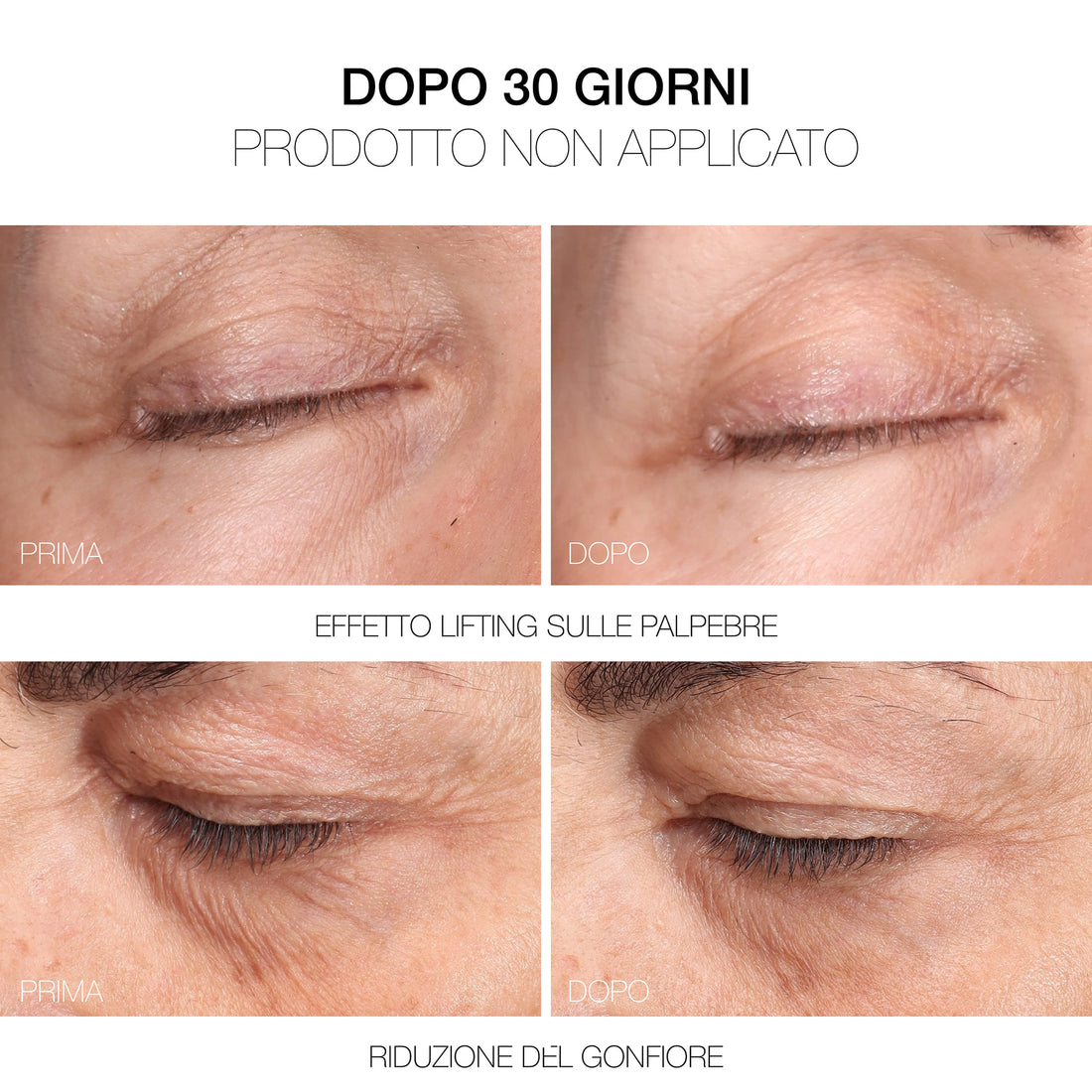 Meso Fill Concealer Fill&correct - Correttore Trattamento Levigante